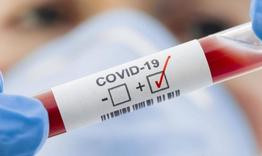 269 нови случая на коронавирус в страната, няма новозаразени в Шуменско 